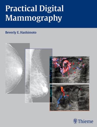 Beispielbild fr Practical Digital Mammography zum Verkauf von HPB-Diamond