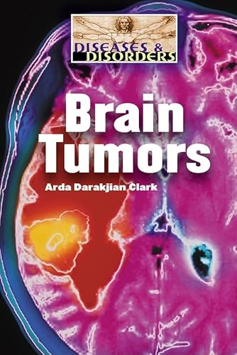 Imagen de archivo de Brain Tumors a la venta por Better World Books