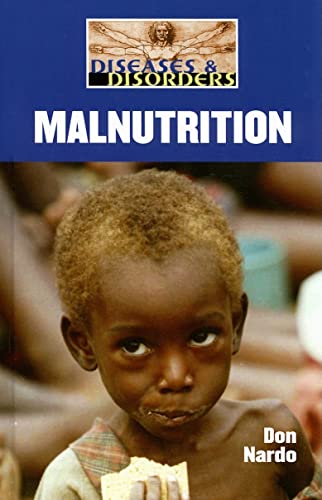 Imagen de archivo de Malnutrition (Diseases and Disorders) a la venta por SecondSale