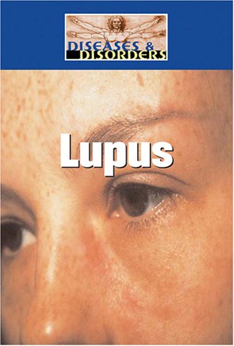 Beispielbild fr Lupus zum Verkauf von Better World Books