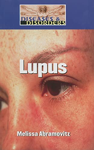9781590189993: Lupus (Diseases and Disorders)