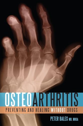 Imagen de archivo de Osteoarthritis: Preventing and Healing Without Drugs a la venta por SecondSale