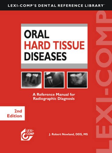 Lexi-Comp's Oral Hard Tissue Diseases - Newland, J. Robert