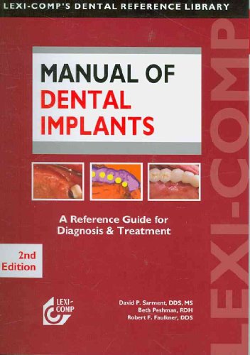Imagen de archivo de Manual of Dental Implants (Lexi-Comp's Dental Reference Library) a la venta por Hay-on-Wye Booksellers