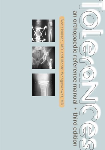 Stock image for Tolerances: An Orthopaedic Reference Manual for sale by Revaluation Books