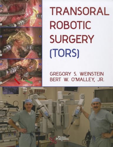 Stock image for Transoral Robotic Surgery (TORS) for sale by Byrd Books