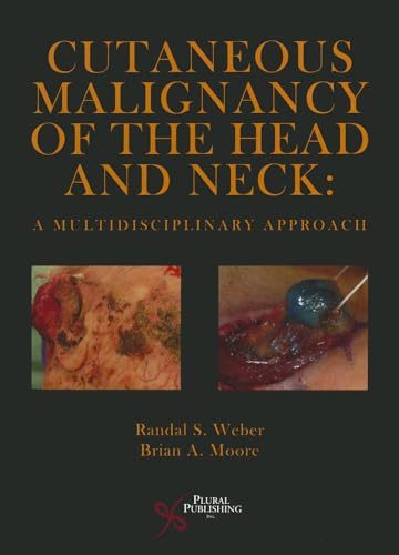 Stock image for Cutaneous Malignancy of the Head and Neck: A Multidisciplinary Approach for sale by Foggypaws