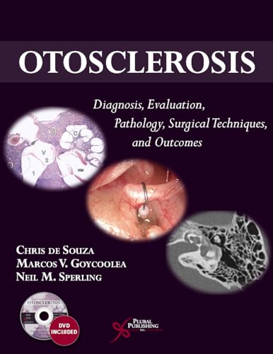 Imagen de archivo de Otosclerosis: Diagnosis, Evaluation, Pathology, Surgical Techniques, and Outcomes a la venta por Learnearly Books