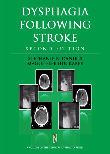 9781597565448: Dysphagia Following Stroke (Clinical Dysphagia)