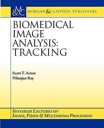 9781598290189: Biomedical Image Analysis: Tracking (Synthesis Lectures on Image, Video, and Multimedia Processing)