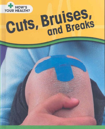 Imagen de archivo de Cuts, Bruises, and Breaks a la venta por Better World Books: West