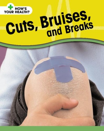 9781599202228: Cuts, Bruises, and Breaks (How's Your Health?)