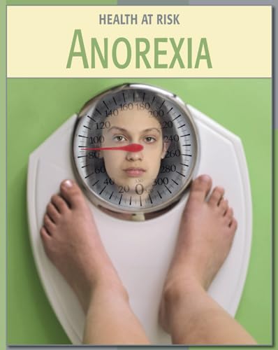 Anorexia (21st Century Skills Library: Health at Risk) (9781602792814) by Stewart, Gail B