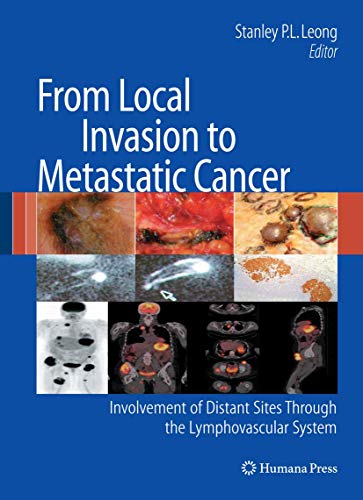 Stock image for From Local Invasion to Metastatic Cancer: Involvement of Distant Sites through the Lymphovasular System for sale by Pride and Prejudice-Books
