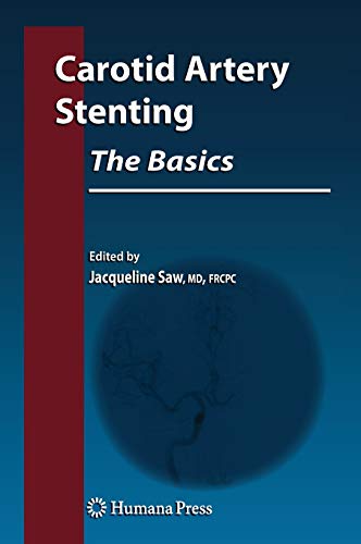 Stock image for Carotid Artery Stenting: The Basics for sale by Basi6 International