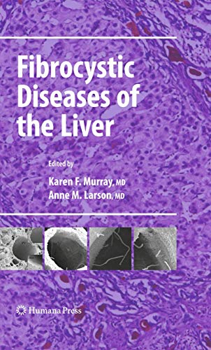 Beispielbild fr Fibrocystic Diseases of the Liver zum Verkauf von ThriftBooks-Dallas