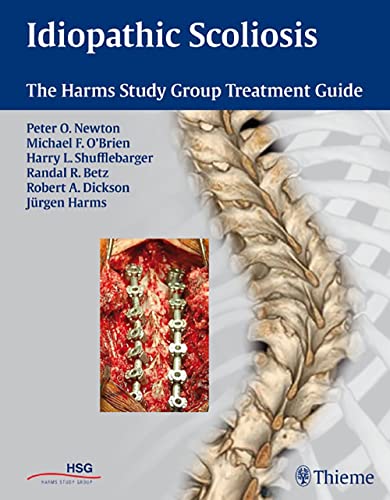 9781604060249: Idiopathic Scoliosis: The Harms Study Group Treatment Guide