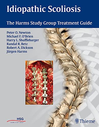 Stock image for Idiopathic Scoliosis: The Harms Study Group Treatment Guide for sale by Front Cover Books