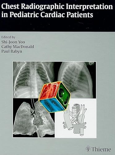 Stock image for Chest Radiographic Interpretation in Pediatric Cardiac Patients for sale by Blackwell's