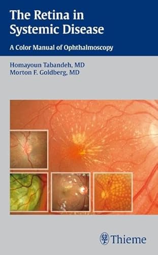 Stock image for The Retina in Systemic Disease: A Color Manual of Ophthalmoscopy for sale by Ergodebooks