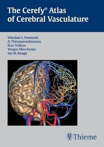 The Cerefy Atlas of Cerebral Vasculature/CD-ROM (9781604060904) by Nowinski, Wieslaw; Thirunavuukarasuu, A.; Volkau, Ihar; Marchenklo, Yevgen; Runge, Val