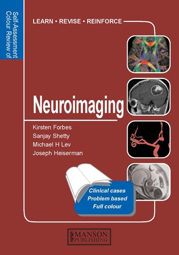 Beispielbild fr Q&A Color Review of Neuroimaging zum Verkauf von HPB-Red