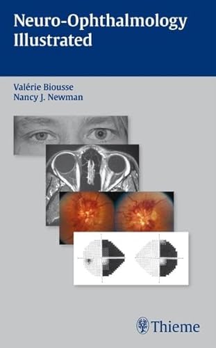 Neuro-Ophthalmology Illustrated (9781604061567) by Biousse, Valerie; Newman, Nancy J.