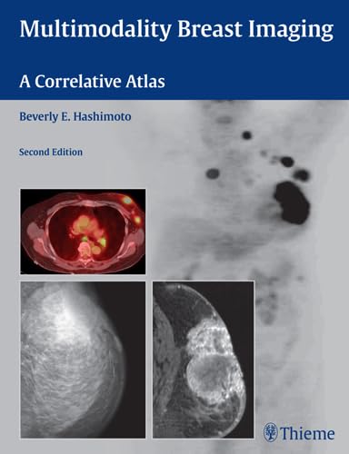 Beispielbild fr Multimodality Breast Imaging: A Correlative Atlas zum Verkauf von HPB-Red
