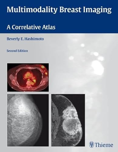 Stock image for Multimodality Breast Imaging: A Correlative Atlas for sale by HPB-Red