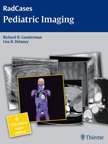 Stock image for Pediatric Imaging (RadCases) for sale by HPB-Red