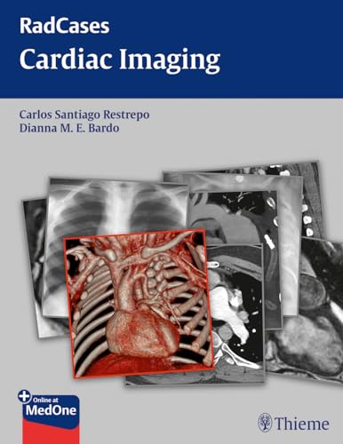 Beispielbild fr Radcases Cardiac Imaging (Radcases Plus Q&A) zum Verkauf von SecondSale