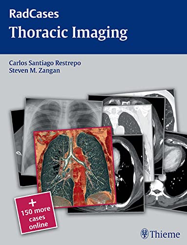 Beispielbild fr Thoracic Imaging zum Verkauf von Better World Books