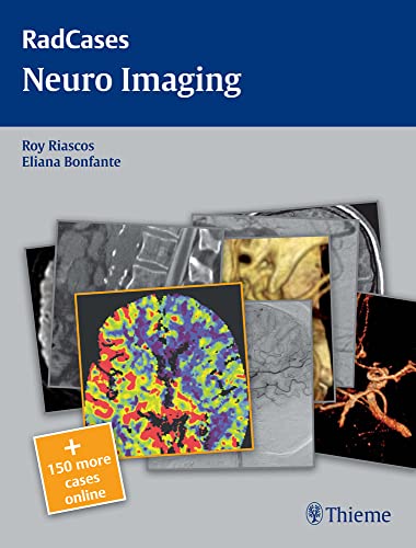 9781604061895: Radcases Neuro Imaging (Radcases Plus Q&A)