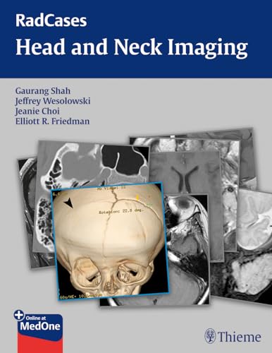 Stock image for RadCases Head and Neck Imaging (Radcases Plus Q&A) for sale by HPB-Red