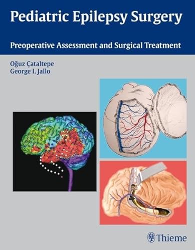 9781604062540: Pediatric Epilepsy Surgery: Preoperative Assessment and Surgical Treatment