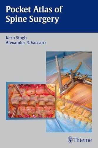 Imagen de archivo de Pocket Atlas of Spine Surgery a la venta por Books Unplugged