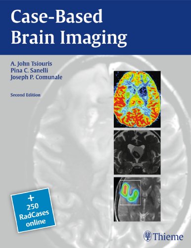 9781604063509: Case-Based Brain Imaging