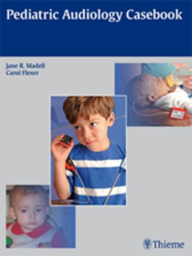 Stock image for Pediatric Audiology Casebook for sale by HPB-Red
