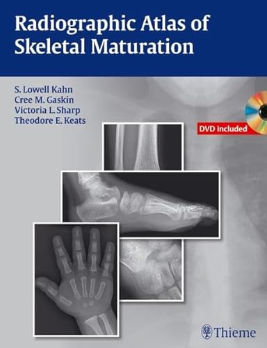 9781604065718: Radiographic Atlas of Skeletal Maturation