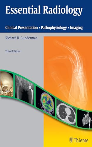 Stock image for Essential Radiology: Clinical Presentation  Pathophysiology  Imaging (Clinical Presentation  Pathophysiology  Imaging) for sale by HPB-Red