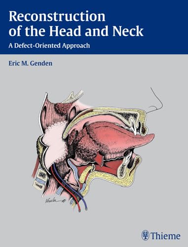 Stock image for RECONSTRUCTION OF THE HEAD AND NECK: A DEFECT-ORIENTED APPROACH 1/E (EXCL. ABC) for sale by Romtrade Corp.