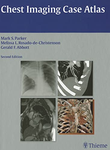 Beispielbild fr Chest Imaging Case Atlas zum Verkauf von Buchpark