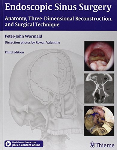 Endoscopic Sinus Surgery: Anatomy, Three-Dimensional Reconstruction, and Surgical Technique - Wormald, Peter J.