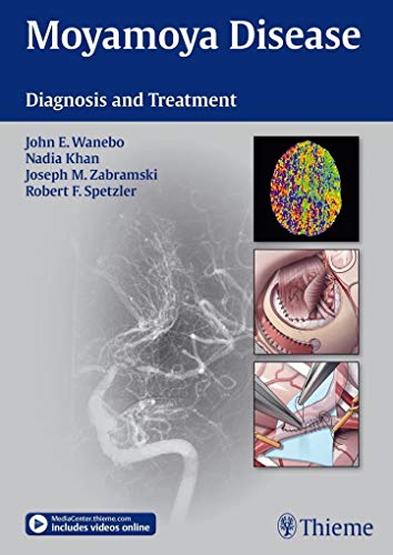 Imagen de archivo de Moyamoya Disease: Diagnosis and Treatment a la venta por SecondSale