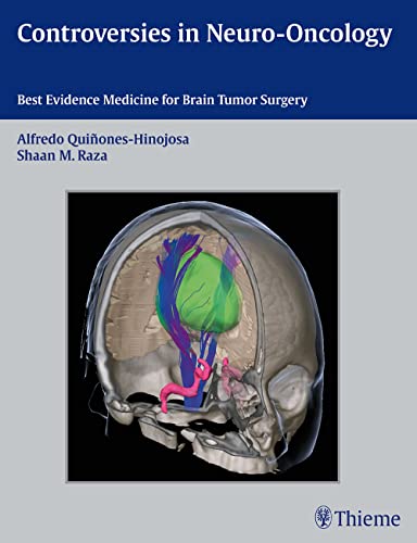 Beispielbild fr Controversies in Neuro-Oncology: Best Evidence Medicine for Brain Tumor Surgery zum Verkauf von AwesomeBooks