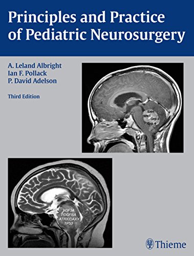 9781604067996: Principles and Practice of Pediatric Neurosurgery