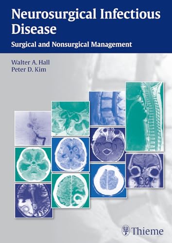 9781604068054: Neurosurgical Infectious Disease: Surgical and Nonsurgical Management