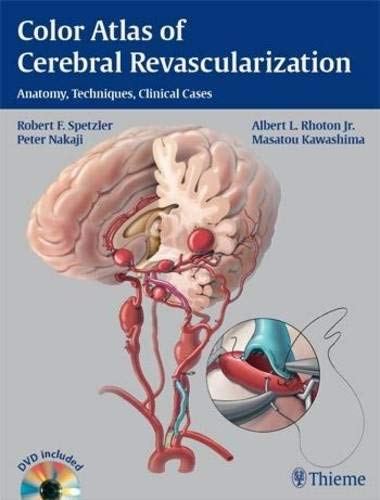 Imagen de archivo de Color Atlas of Cerebral Revascularization a la venta por Books Puddle