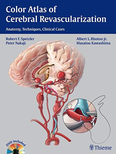 Color Atlas of Cerebral Revascularization: Anatomy, Techniques, Clinical Cases (9781604068221) by Spetzler, Robert F.; Rhoton, Albert L.; Nakaji, Peter; Kawashima, Masatou