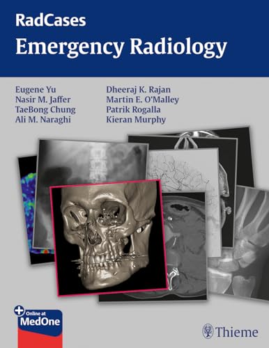 Stock image for Radcases Emergency Radiology (Radcases Plus Q&A) for sale by GF Books, Inc.